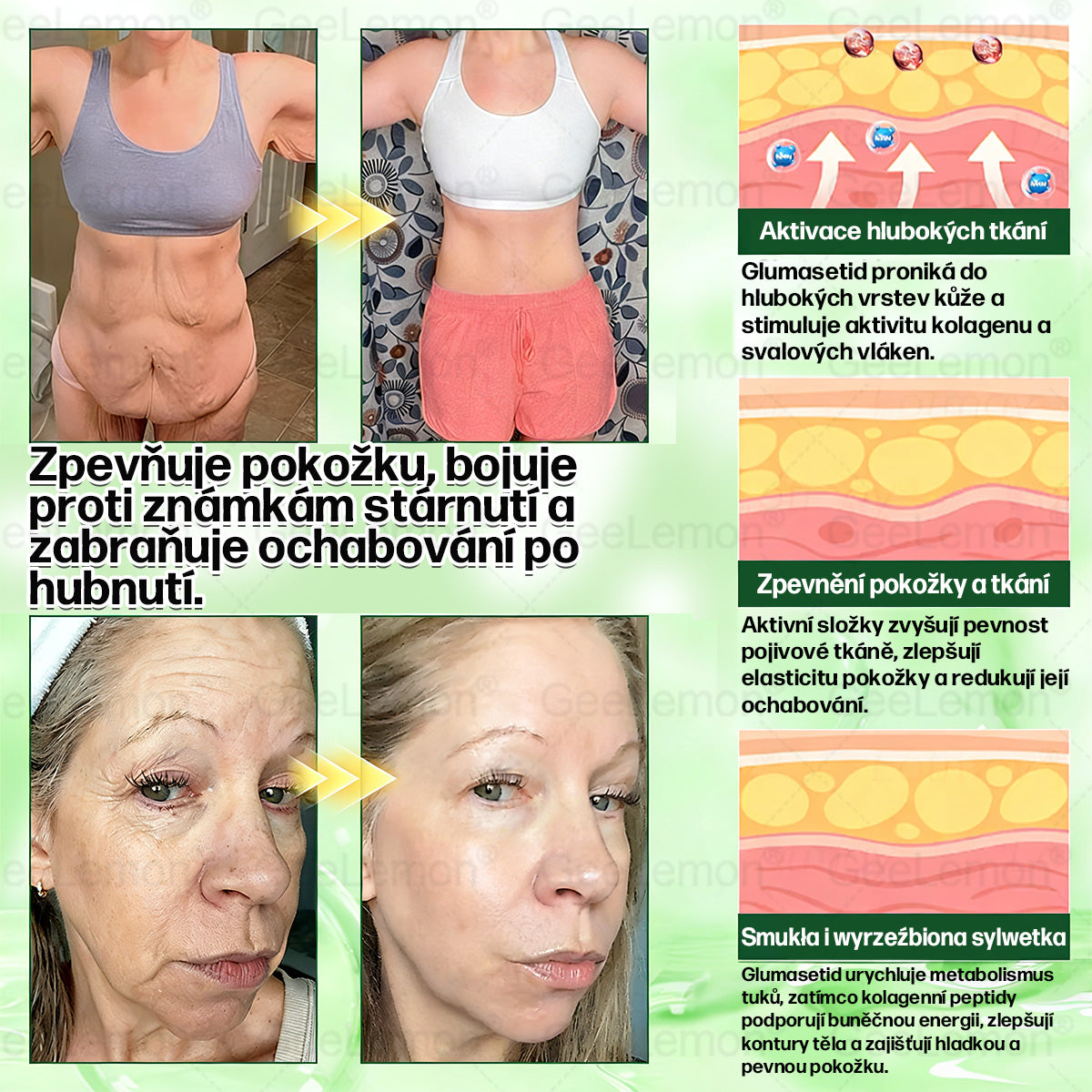 Oficiální prodejna BENU | 🎁 𝐆𝐞𝑒𝑙𝑒𝐦𝐨𝐧® Glum𝐚𝐬𝐞tide 8 v 1 – Zeštíhlující nano mikrojihlový náplast 🇨🇿 Jen 1× denně ✅ Viditelné změny za 7 dní – na obezitu, kardiovaskulární zdraví, diabetes a kloubní problémy