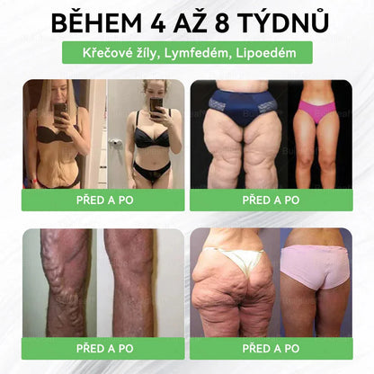 🌿 Oficiální obchod ČR | GLP-1 8-v-1 Fit & Vital Řešení (Jednou denně, viditelné změny za 7 dní) ✅ Obezita, kardiovaskulární zdraví, cukrovka, spánková apnoe, zdraví střev, problémy se klouby a dalš
